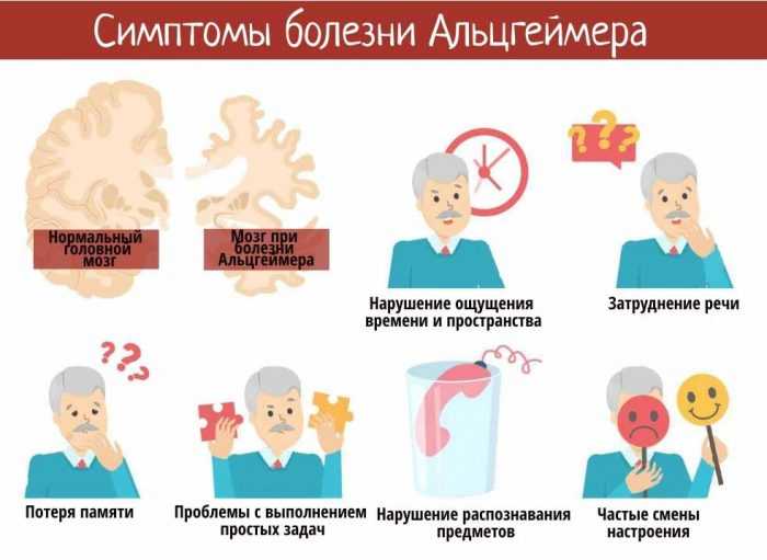 Причины и стадии болезни альцгеймера