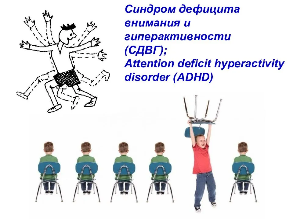 | синдром дефицита внимания и гиперактивности: лечение у детей сдвг