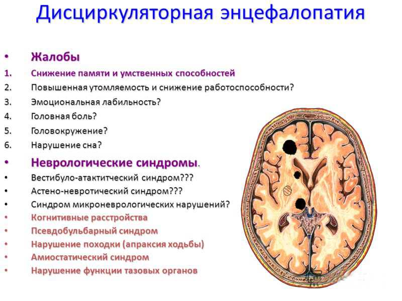 Энцефалопатия ️: симптомы, признаки и лечение энцефалопатии мозга